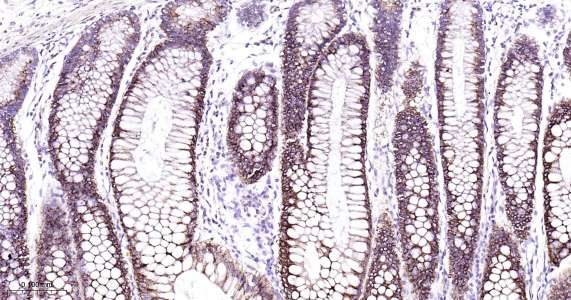 人环氧合酶2即用型免疫组化试剂盒-IHC0408H